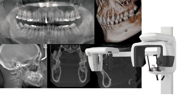 歯科用3DCTで歯や顎の骨内部まで把握