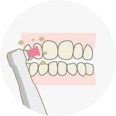 歯のクリーニングと自宅での使用法説明