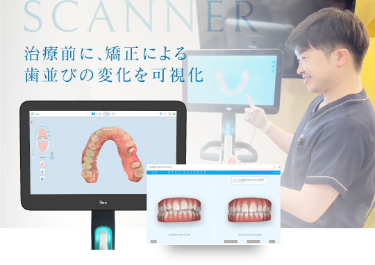 治療前に、矯正による歯並びの変化を可視化